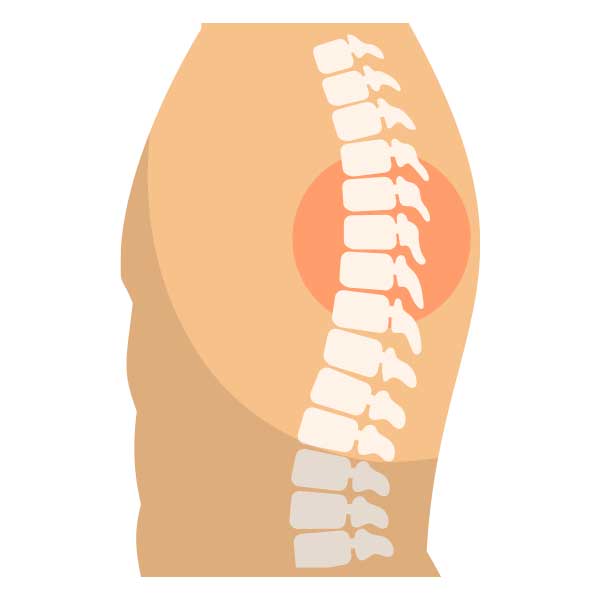 artrosis que afecta a la columna vertebral