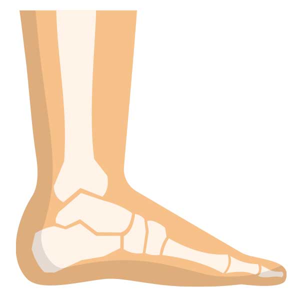 la artrosis puede afectar a los pies