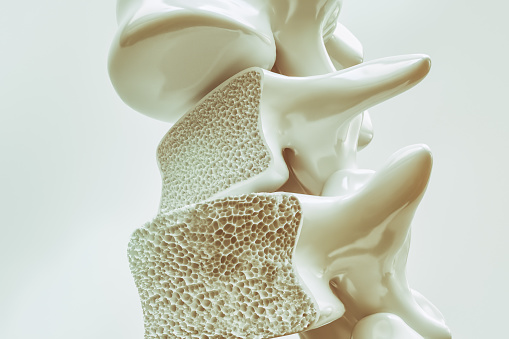 Columna vertebral con osteorporosis
