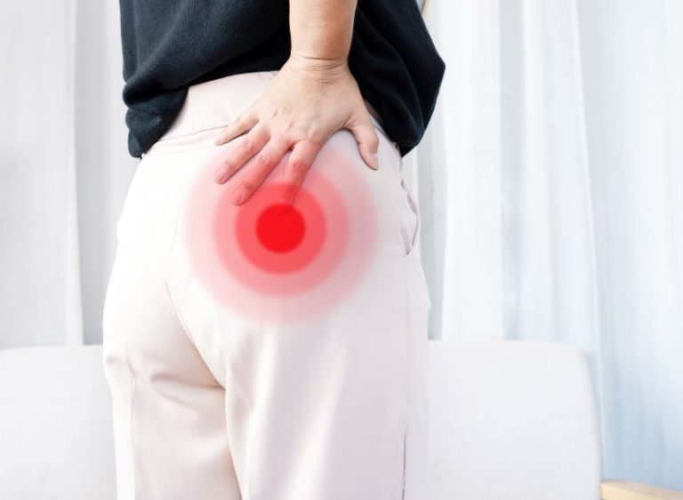 ¿Qué provoca el síndrome piriforme y cuál es su tratamiento?