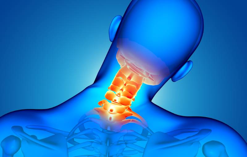 Tratamiento de hernia cervical en Medical Exercise