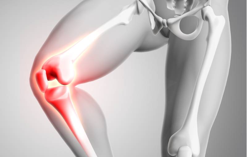 Modelo 3D de esqueleto mostrando dolor en la rodilla